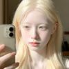 白化病女孩婷婷