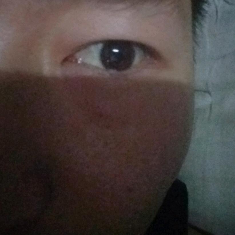 glpaad