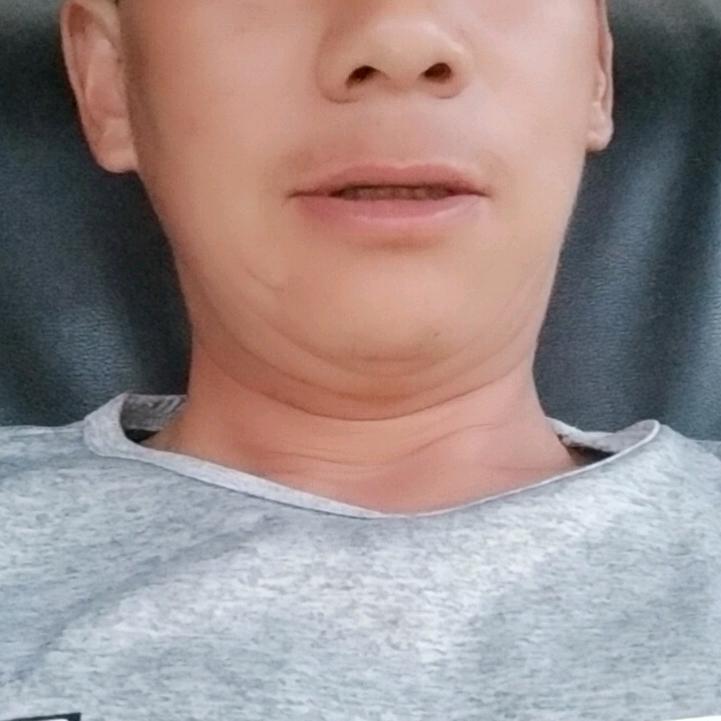刘友成