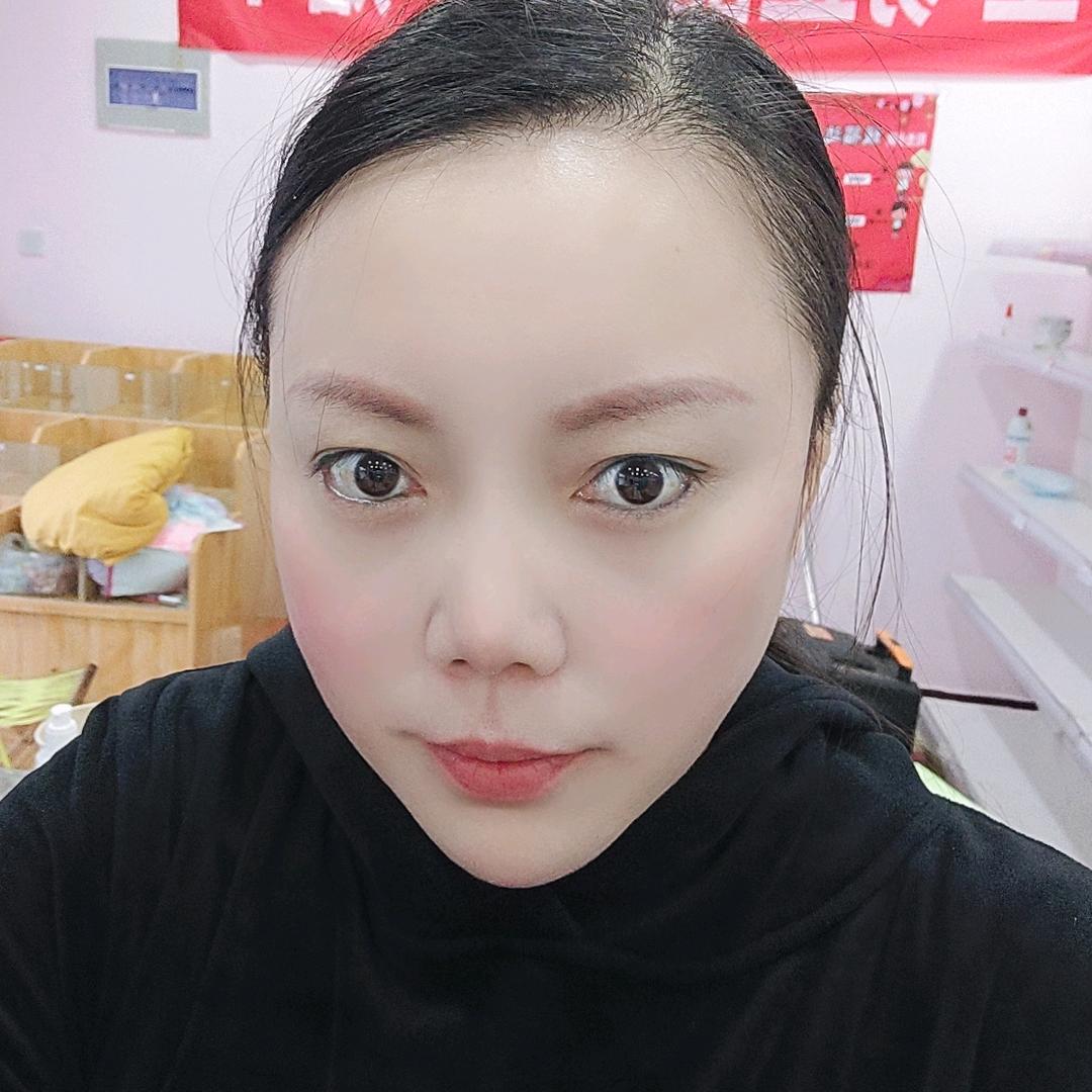 积累的粪球