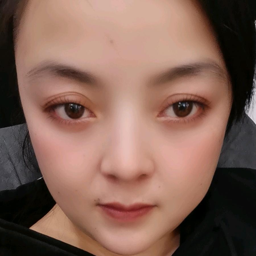 佳