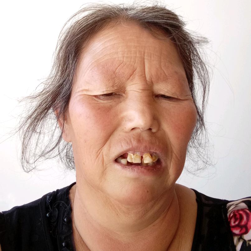 莲花