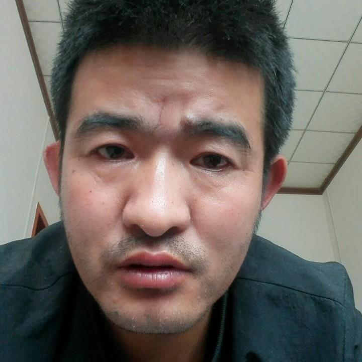 阳光灿烂