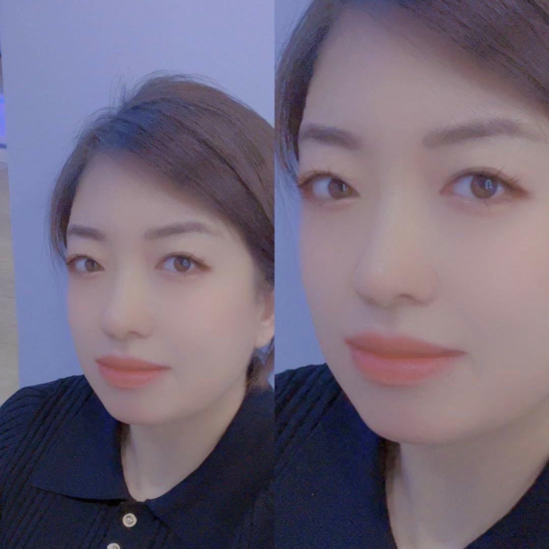 祁县皮肤管理阿瑞