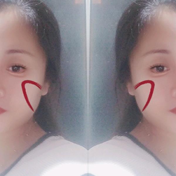 梅铃
