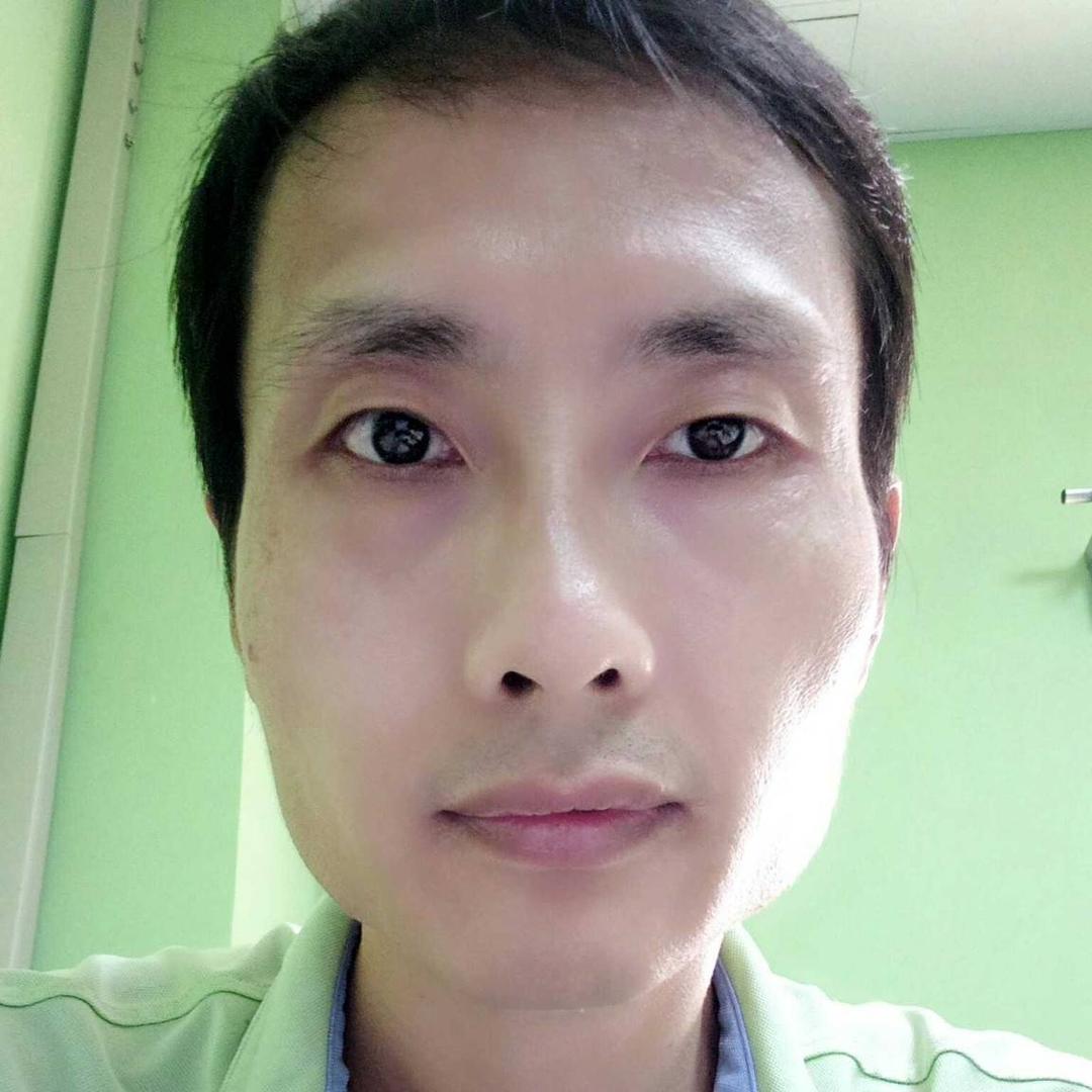 Yyj鱿鱼