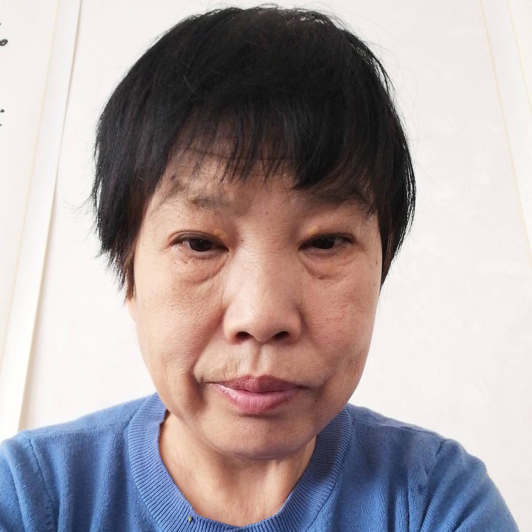 类风湿晨星姐姐