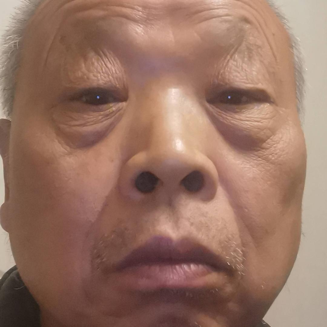 铝合金制作