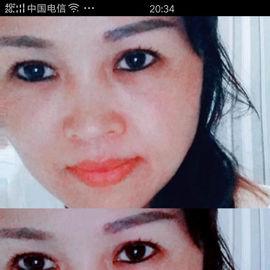苦妮