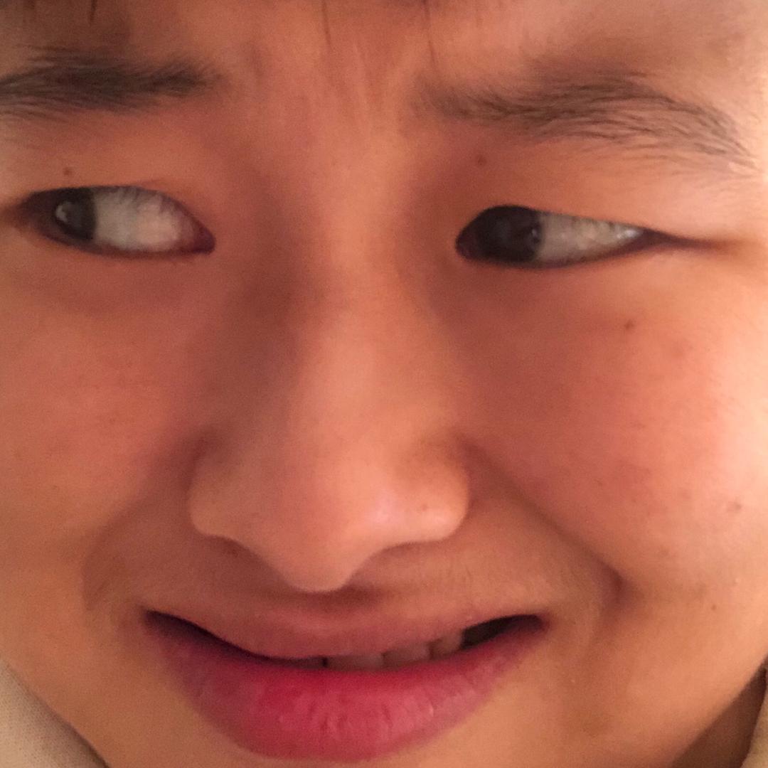 刘小策瘦咯