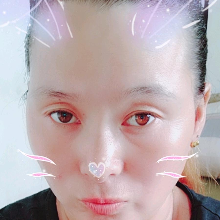 烧伤后的我，该何去何从。