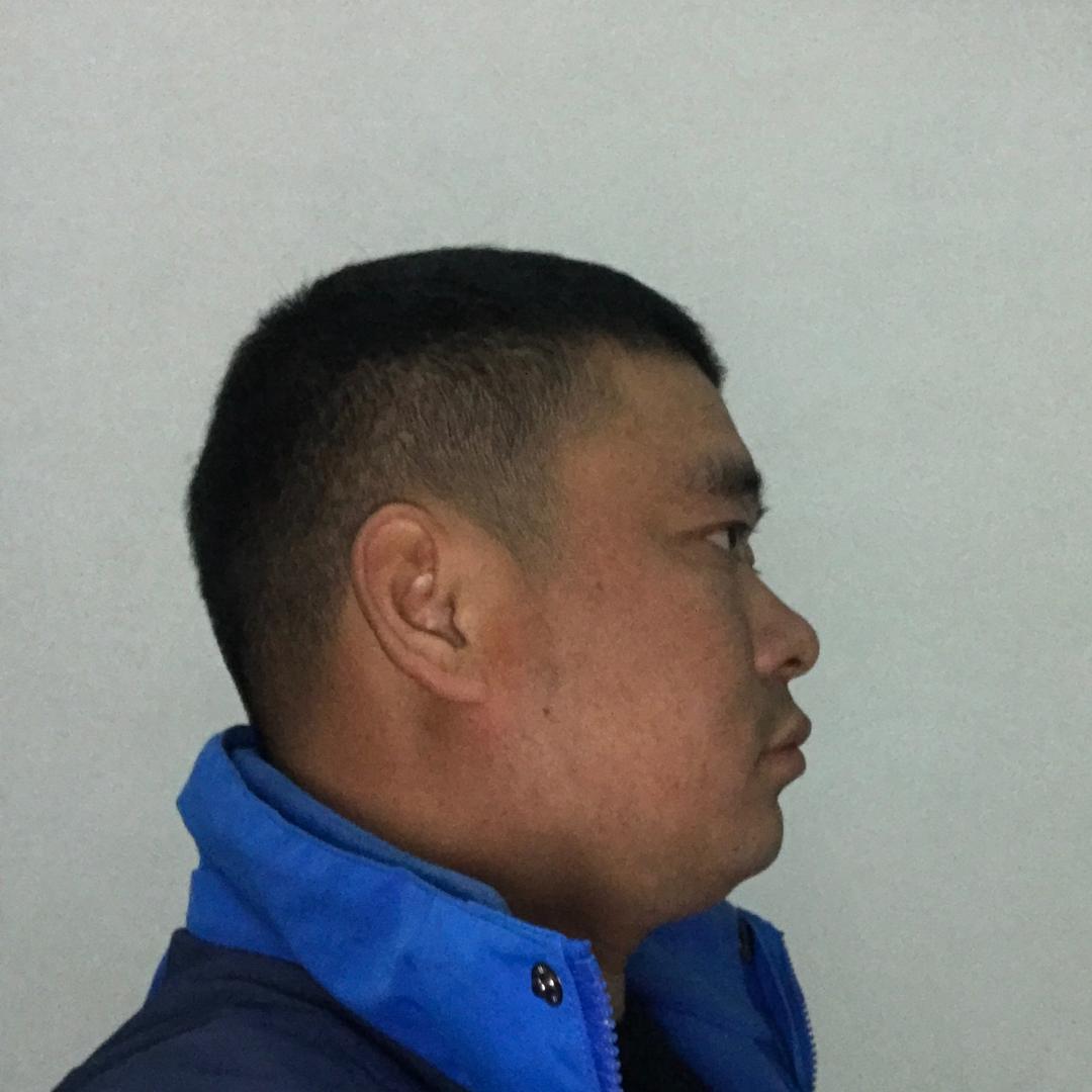 张许