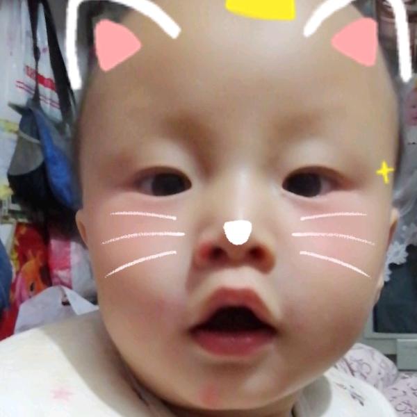 琳宝宝