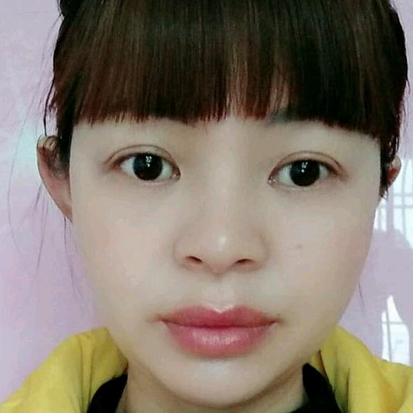陈丽