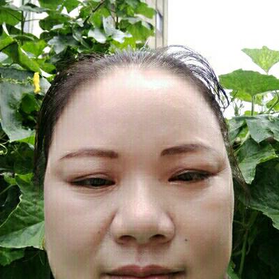 金花