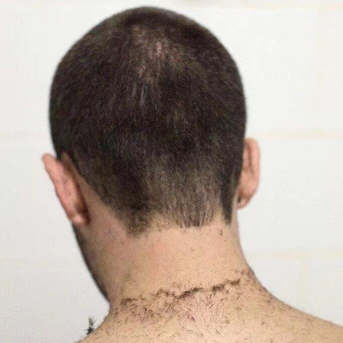 阿發