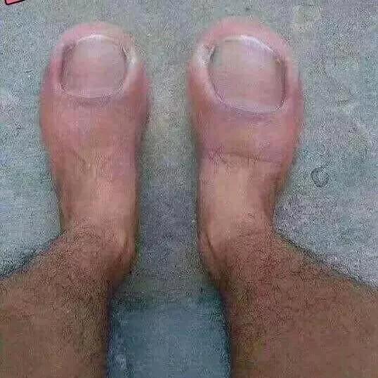 YY