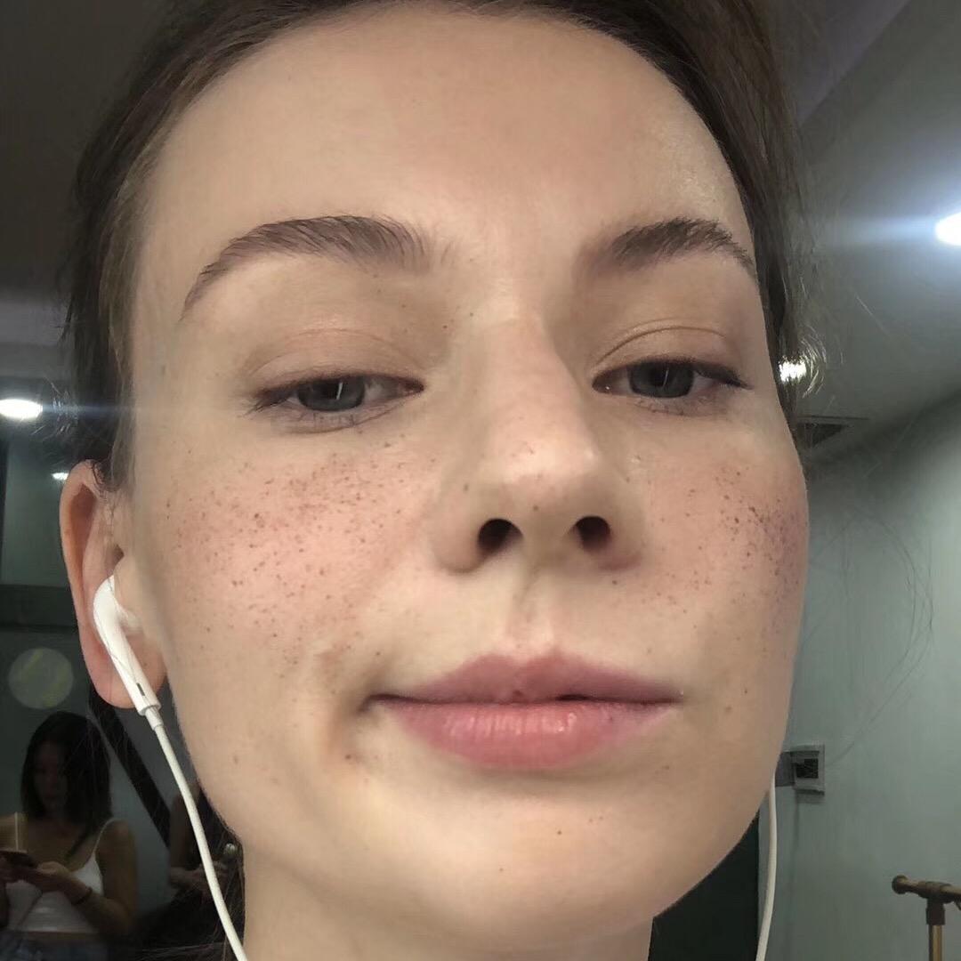 黄绿灯