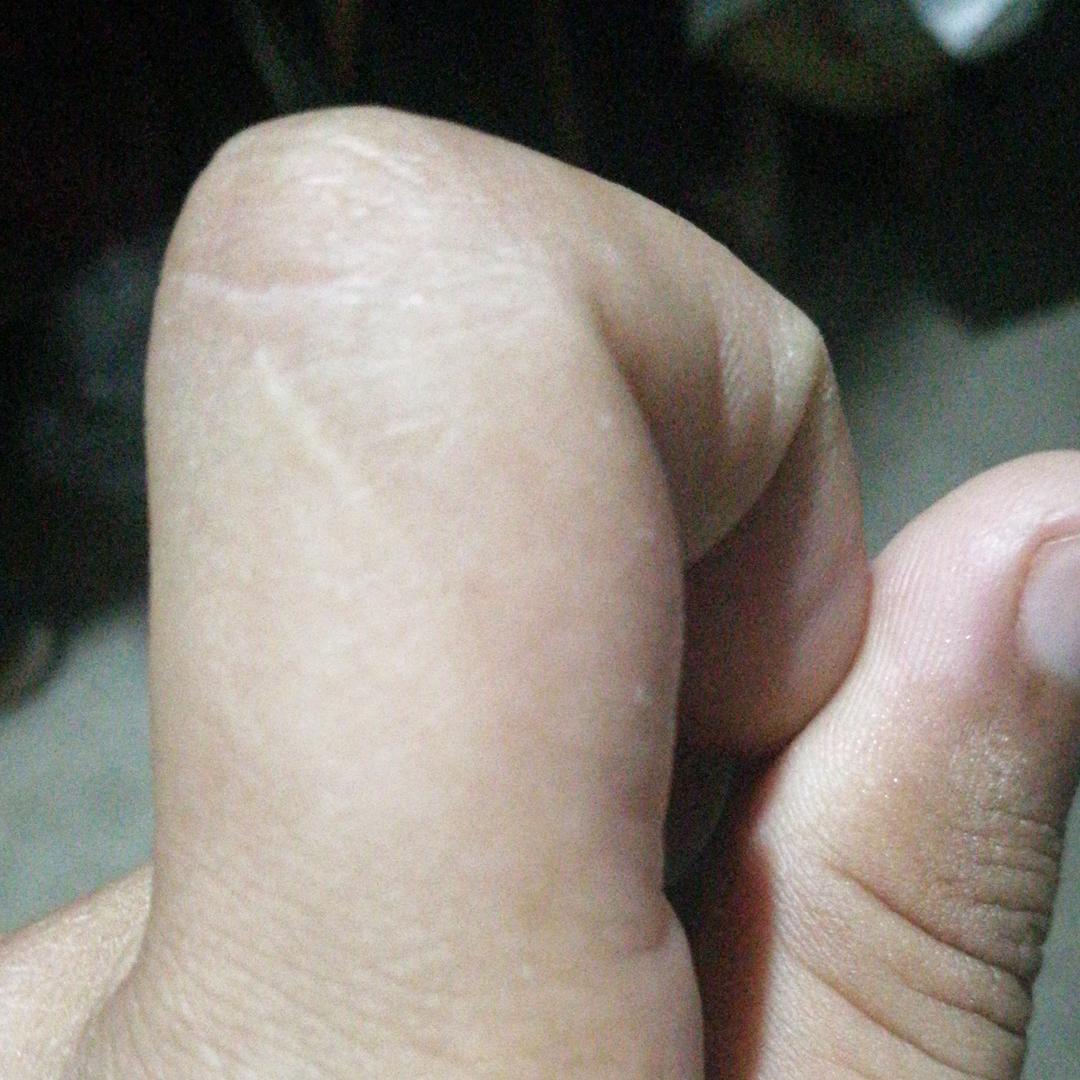 蛋