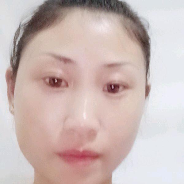钟娟
