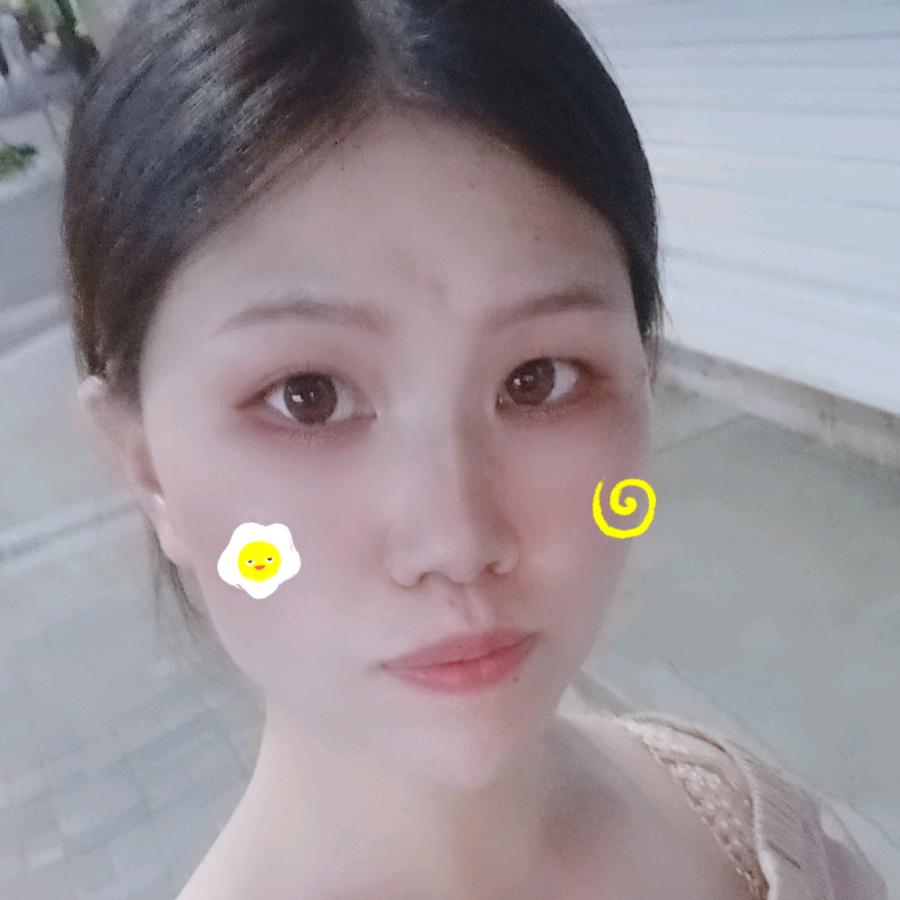 菲