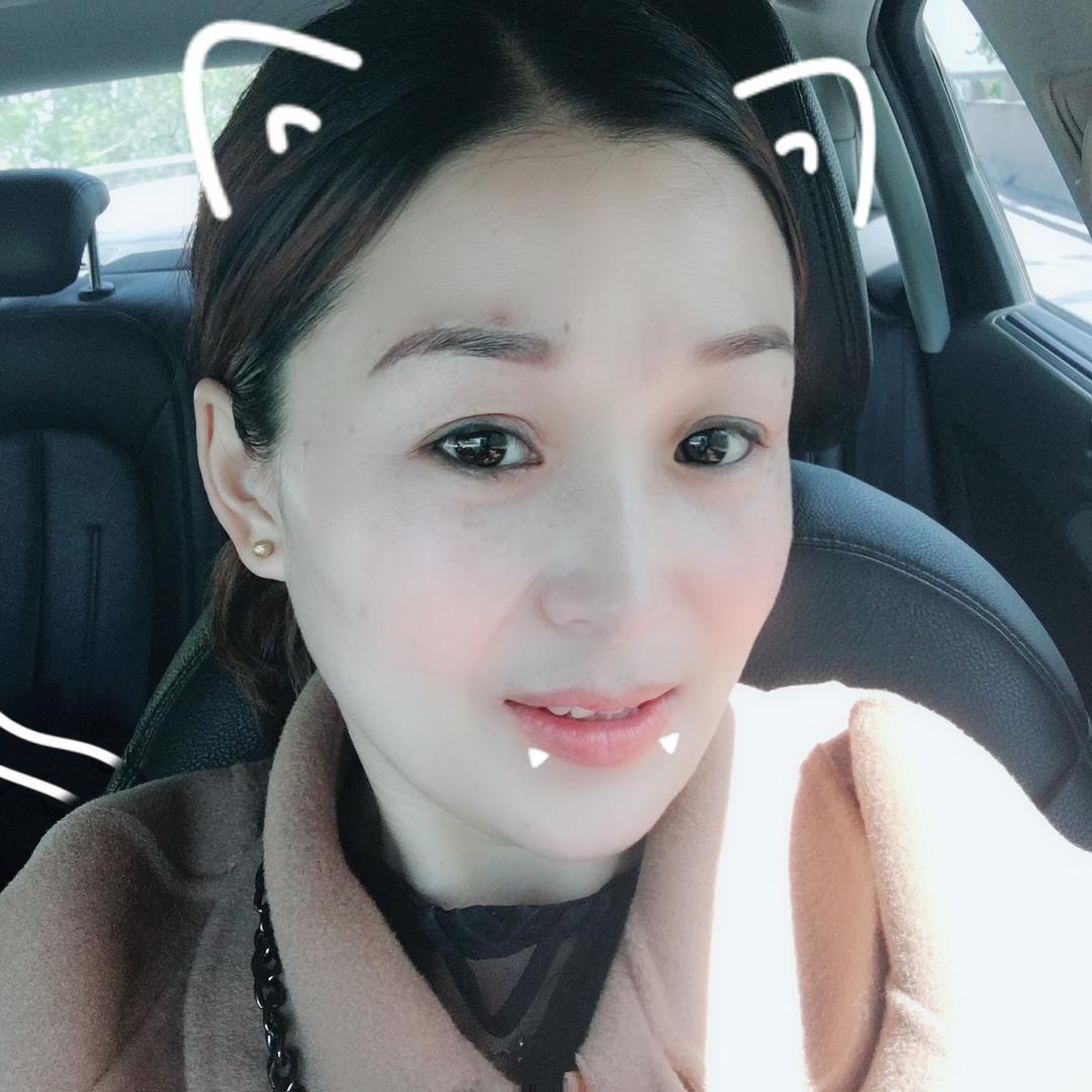 云