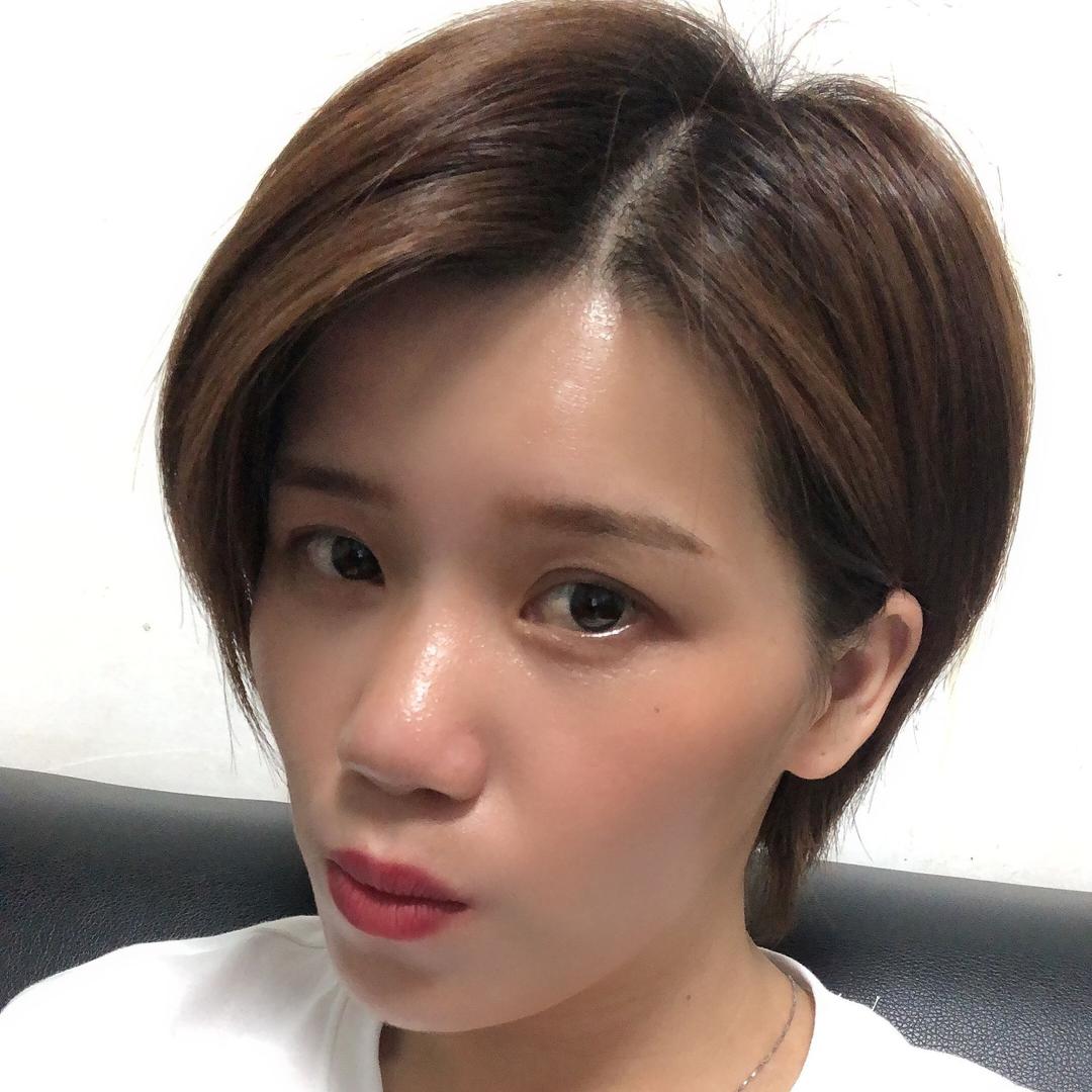 梅梅（SLE）