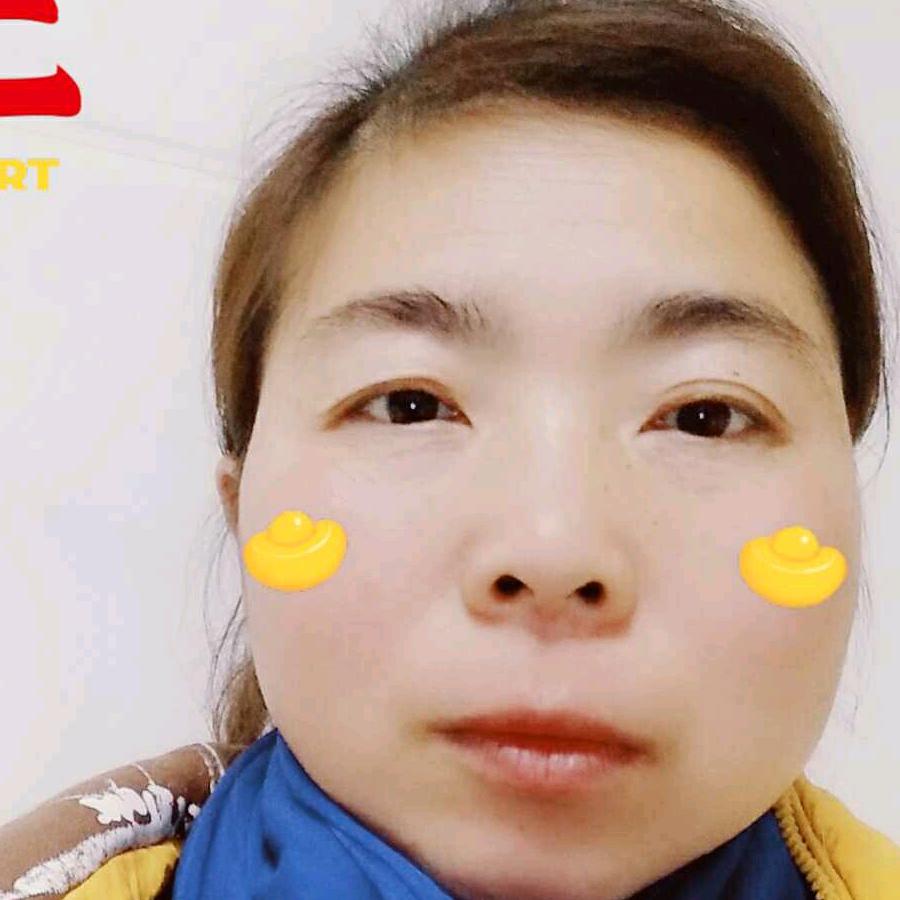 黄琰