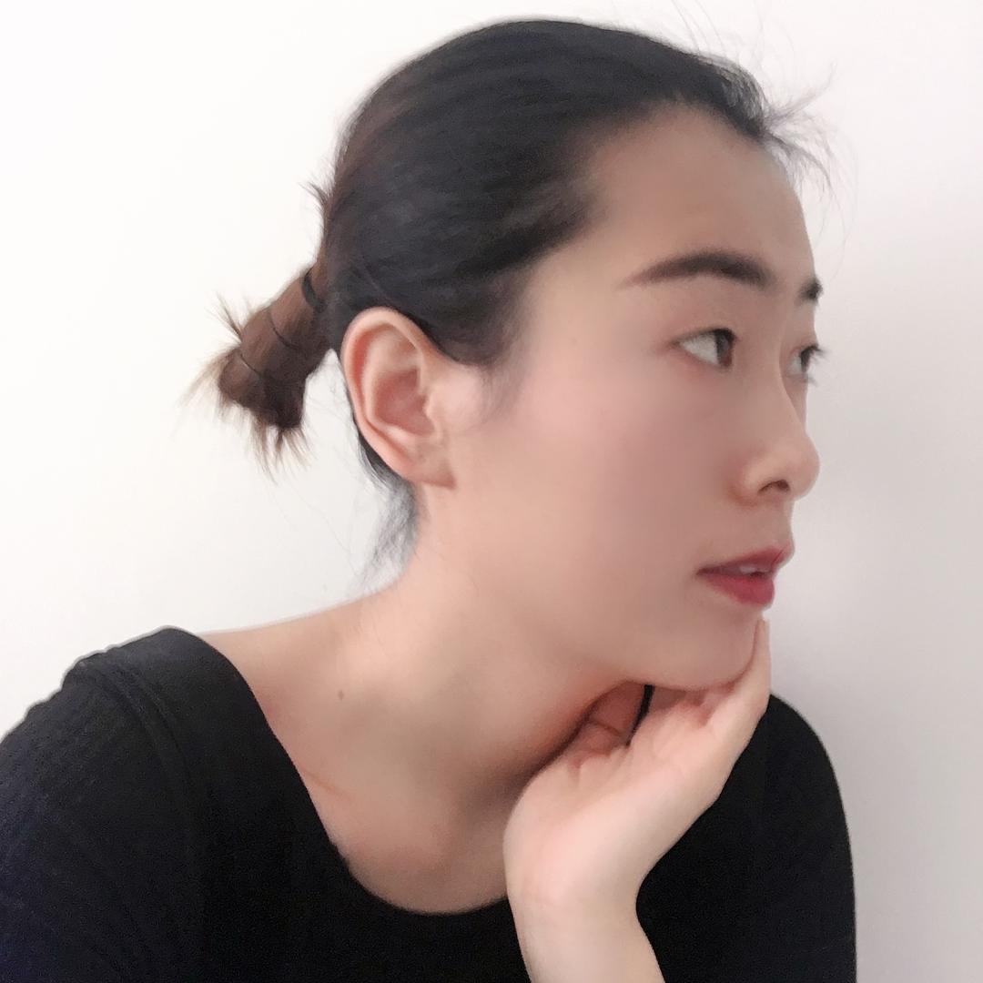 袁菲