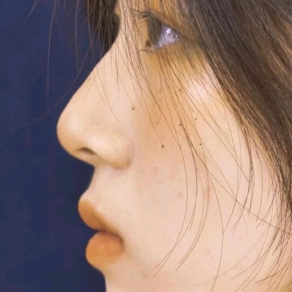末苏
