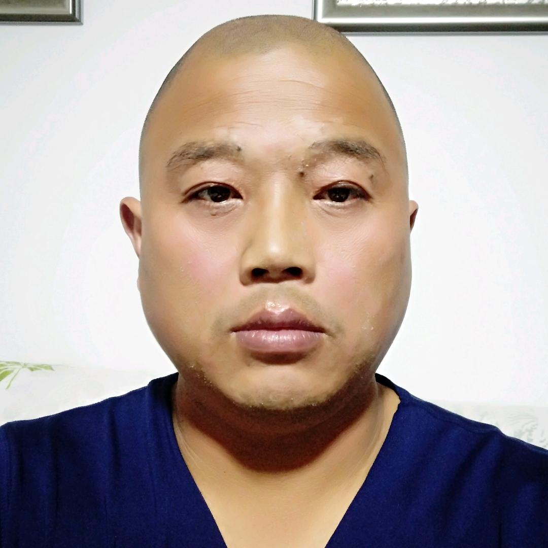 辉哥