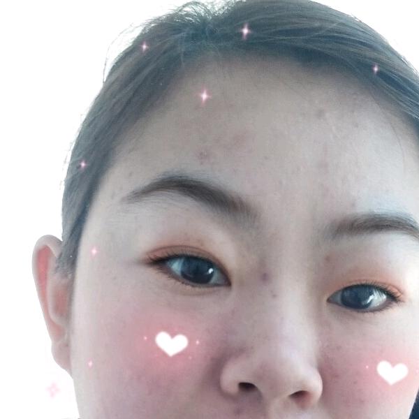 宝贝
