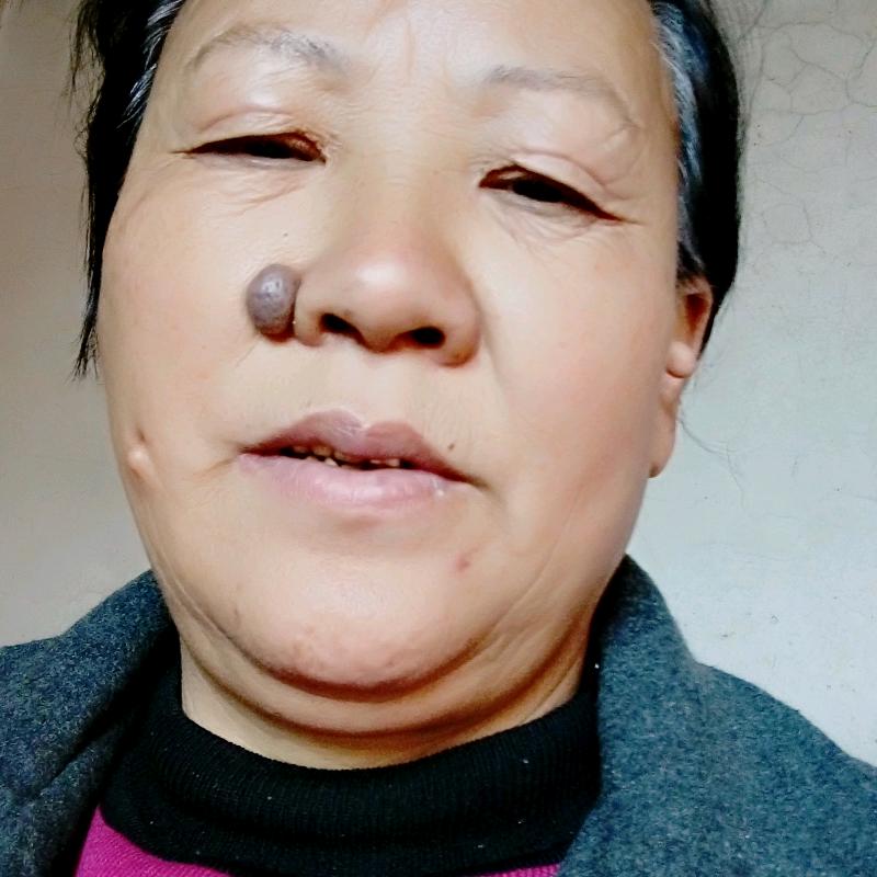 李发珍