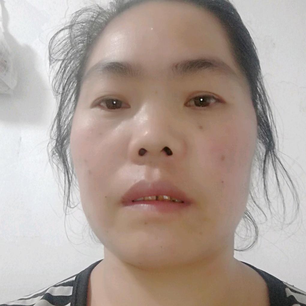袁付美