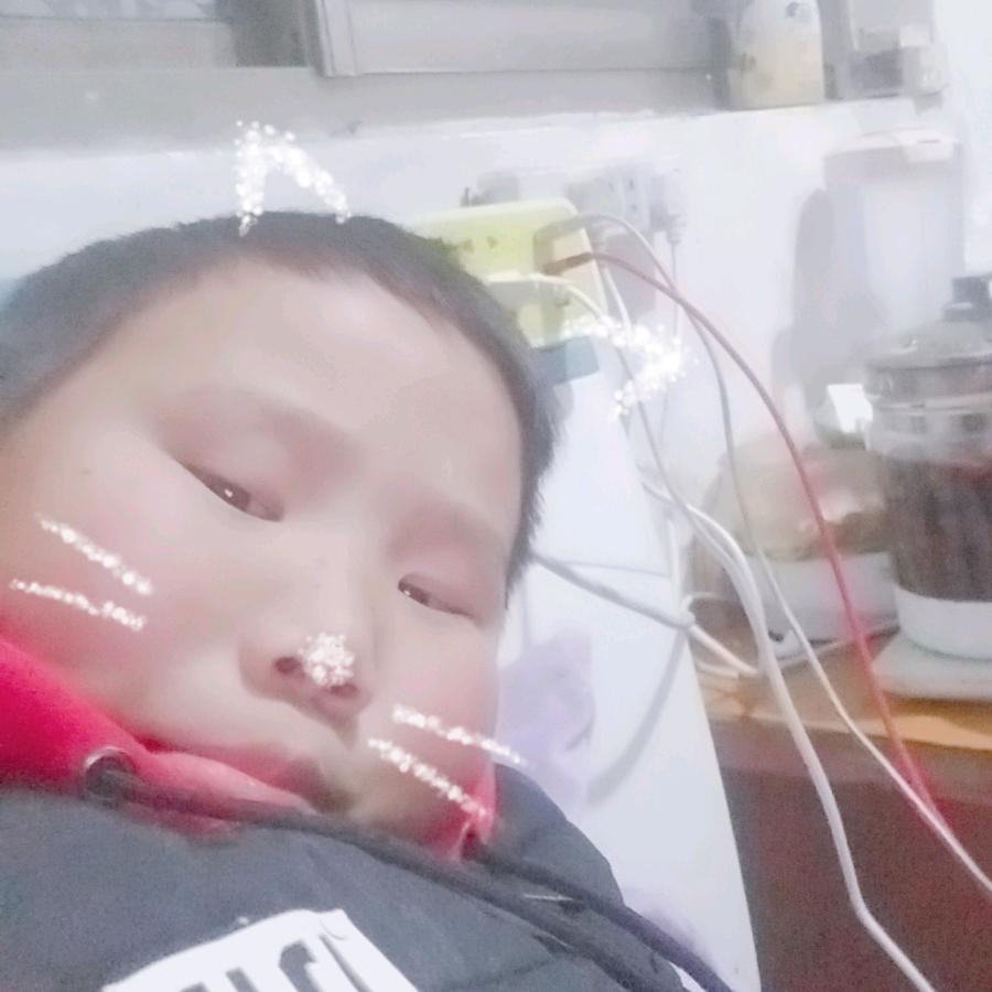 张大