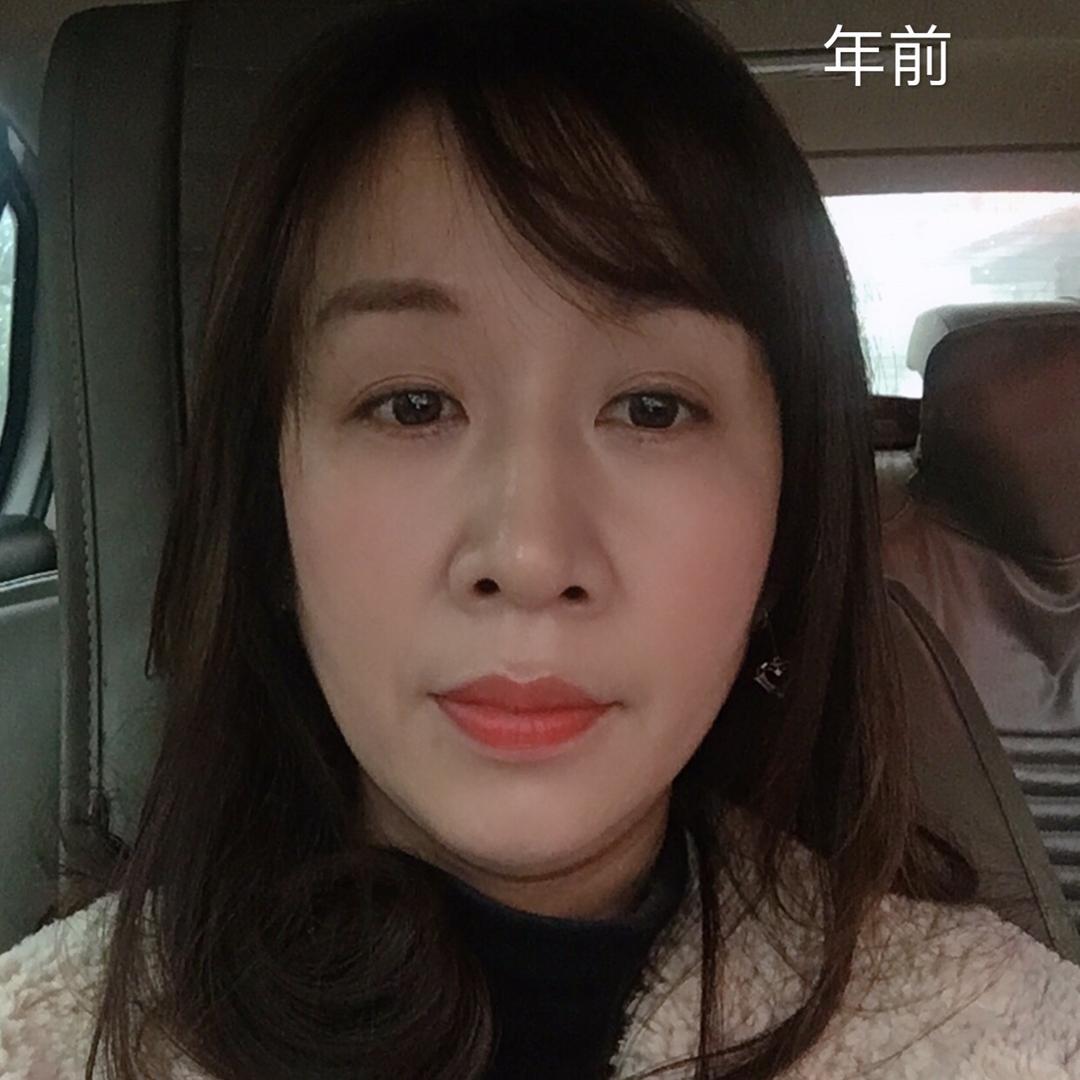 琴琴