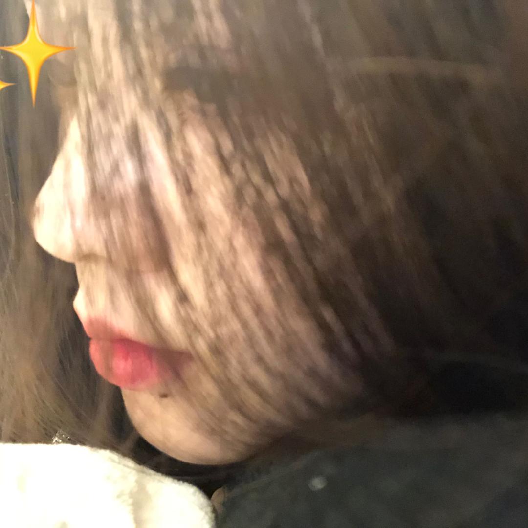 阿璇