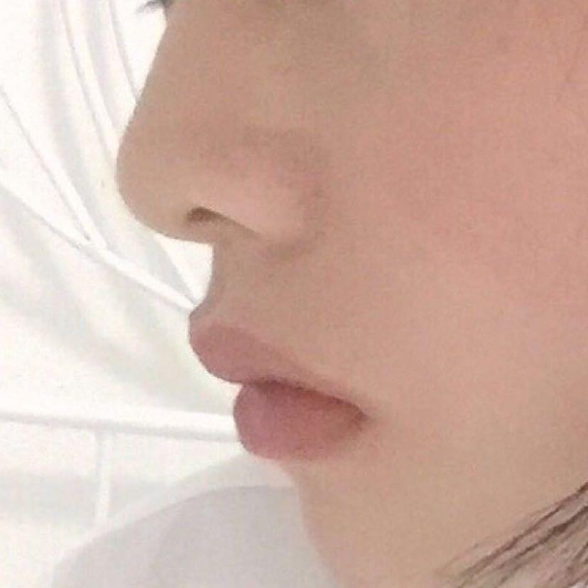 闪