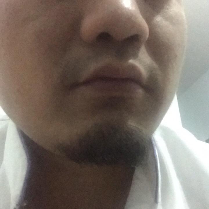 松