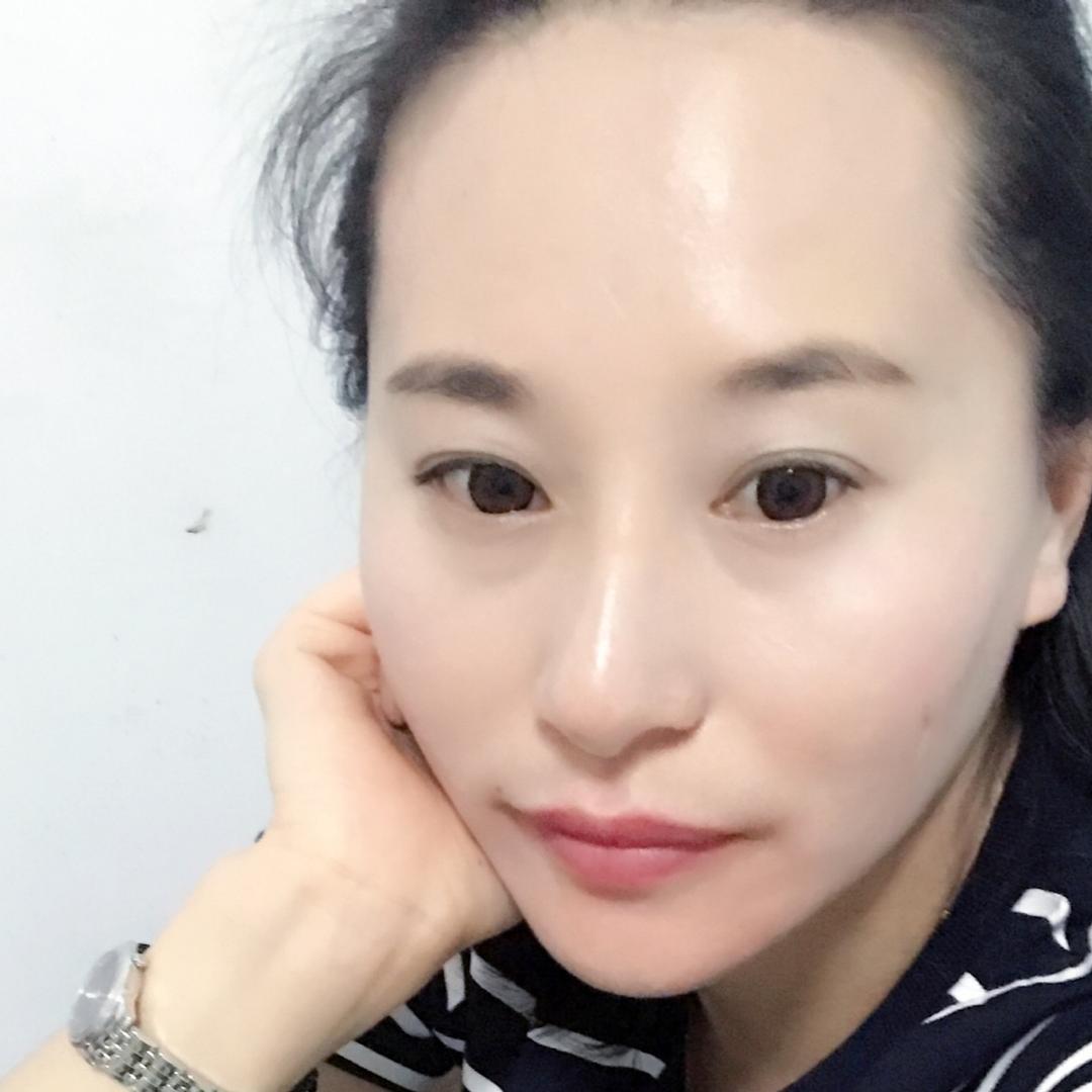 晴
