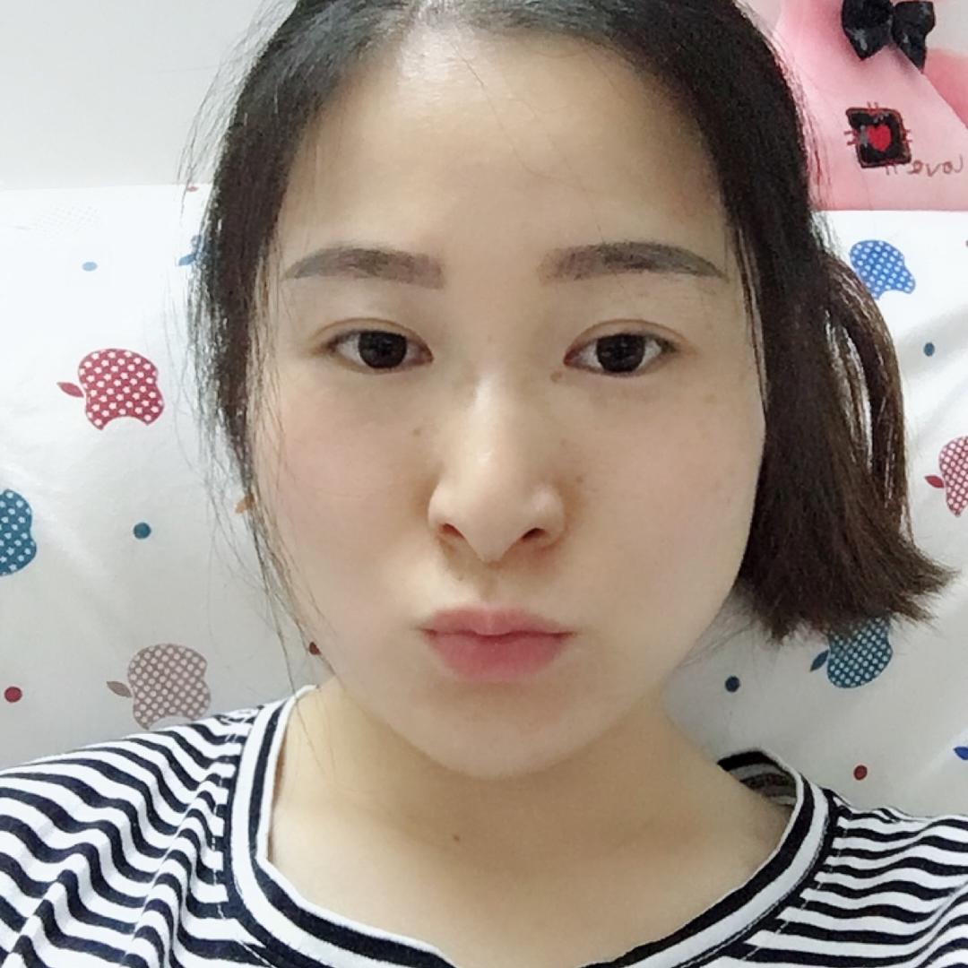 雨苏