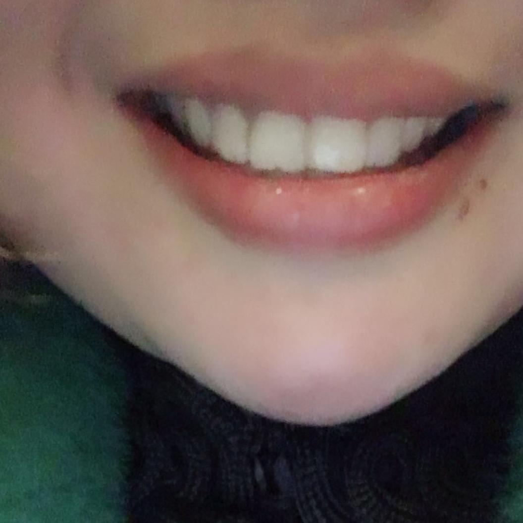 玲玲