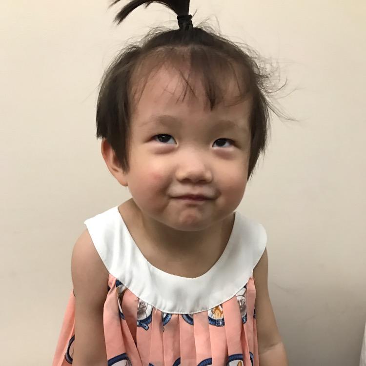 YY