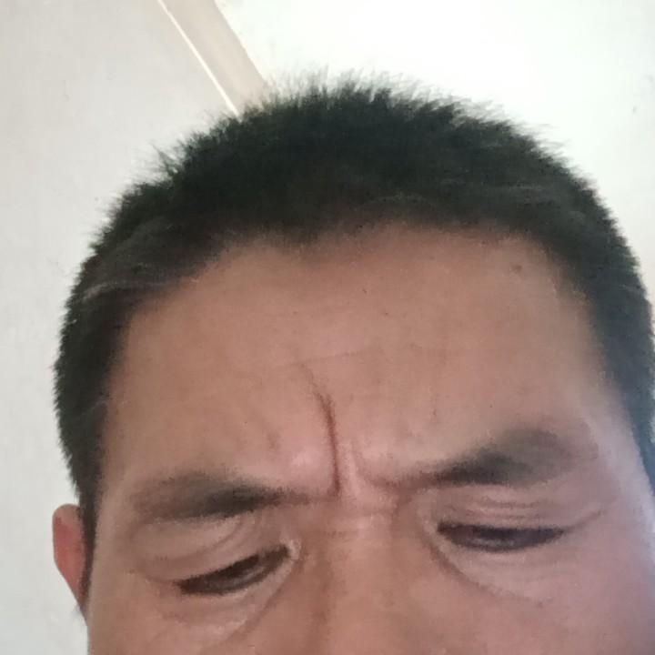 安东