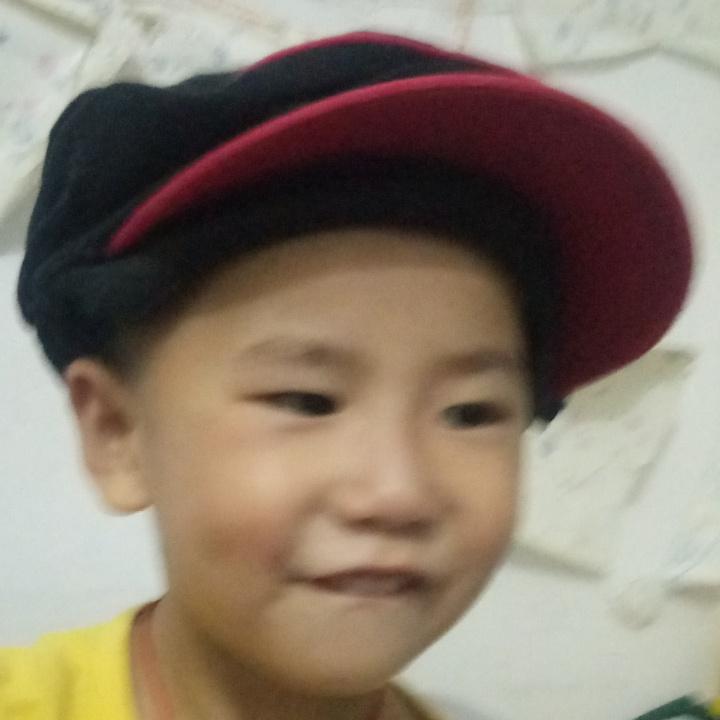 克漆头儿青痛