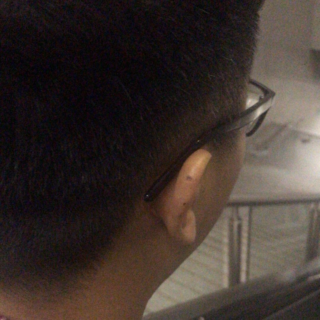 小张