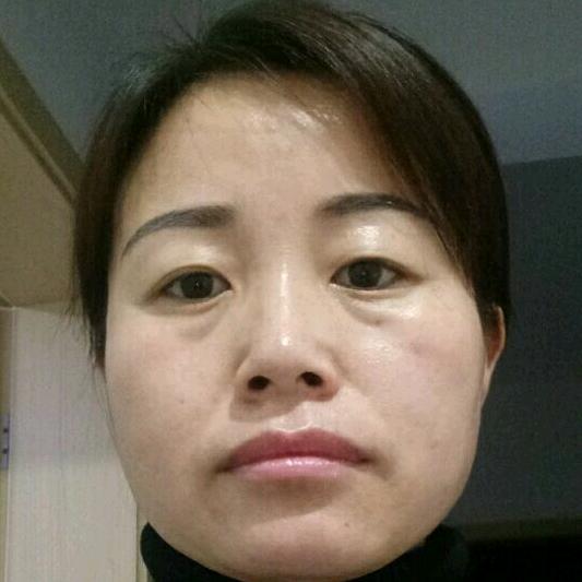 戴钻戒的小手