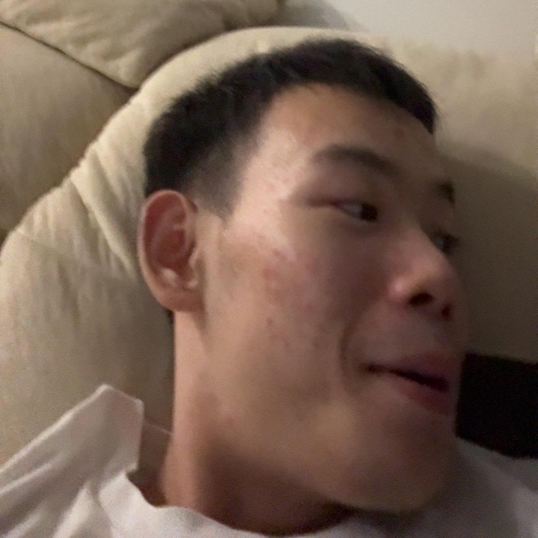 -------.