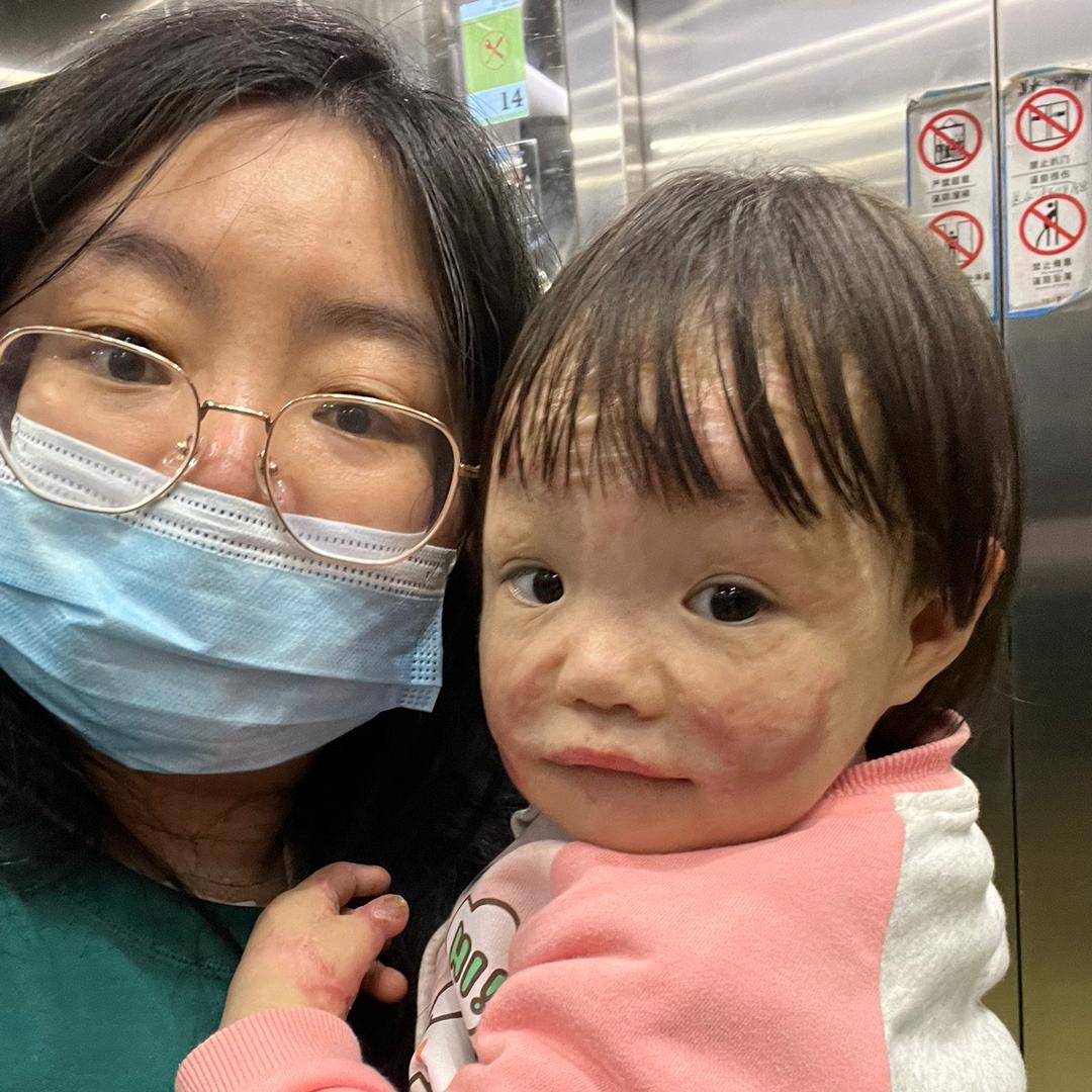 妍宝康复成长记
