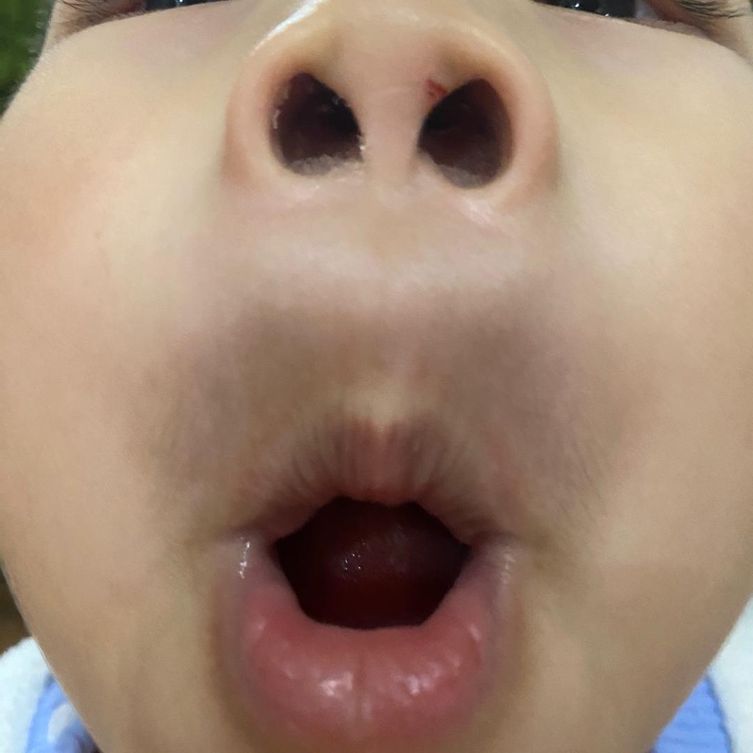 Dish邸